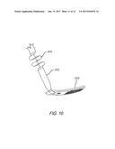 Electrode Arrays for a Visual Prosthesis diagram and image