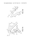 TINE FIXATION COMPONENTS FOR IMPLANTABLE MEDICAL DEVICES diagram and image