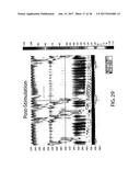 Device and Implantation System for Electrical Stimulation of Biological     Systems diagram and image