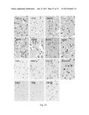 HUMAN-DERIVED ANTI-HUNTINGTIN (HTT) ANTIBODIES AND USES THEREOF diagram and image