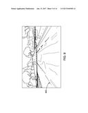 SYSTEM AND METHOD FOR IMAGE BASED VEHICLE LOCALIZATION diagram and image