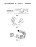 METHOD FOR AUTOMATIC TOOTH TYPE RECOGNITION FROM 3D SCANS diagram and image