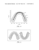 METHOD FOR AUTOMATIC TOOTH TYPE RECOGNITION FROM 3D SCANS diagram and image