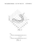 METHOD FOR AUTOMATIC TOOTH TYPE RECOGNITION FROM 3D SCANS diagram and image