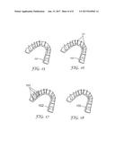 METHOD FOR AUTOMATIC TOOTH TYPE RECOGNITION FROM 3D SCANS diagram and image