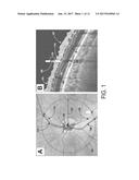 OPTICAL COHERENCE TOMOGRAPHY GLAUCOMA DETECTION BASED ON RETINAL VESSEL     RELIEF HEIGHT diagram and image