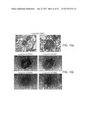 GENETICALLY MODIFIED MICE AND ENGRAFTMENT diagram and image