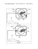 AN ARTICULATED STRUCTURED LIGHT BASED-LAPAROSCOPE diagram and image
