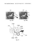 AN ARTICULATED STRUCTURED LIGHT BASED-LAPAROSCOPE diagram and image