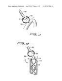 VACUUM ASSISTED SURGICAL DISSECTION TOOLS diagram and image