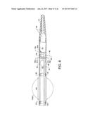 DIRECT STREAM HYDRODYNAMIC CATHETER SYSTEM diagram and image