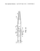 DIRECT STREAM HYDRODYNAMIC CATHETER SYSTEM diagram and image