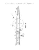 DIRECT STREAM HYDRODYNAMIC CATHETER SYSTEM diagram and image