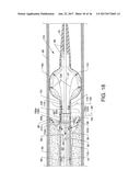 DIRECT STREAM HYDRODYNAMIC CATHETER SYSTEM diagram and image