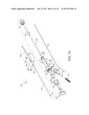 DIRECT STREAM HYDRODYNAMIC CATHETER SYSTEM diagram and image