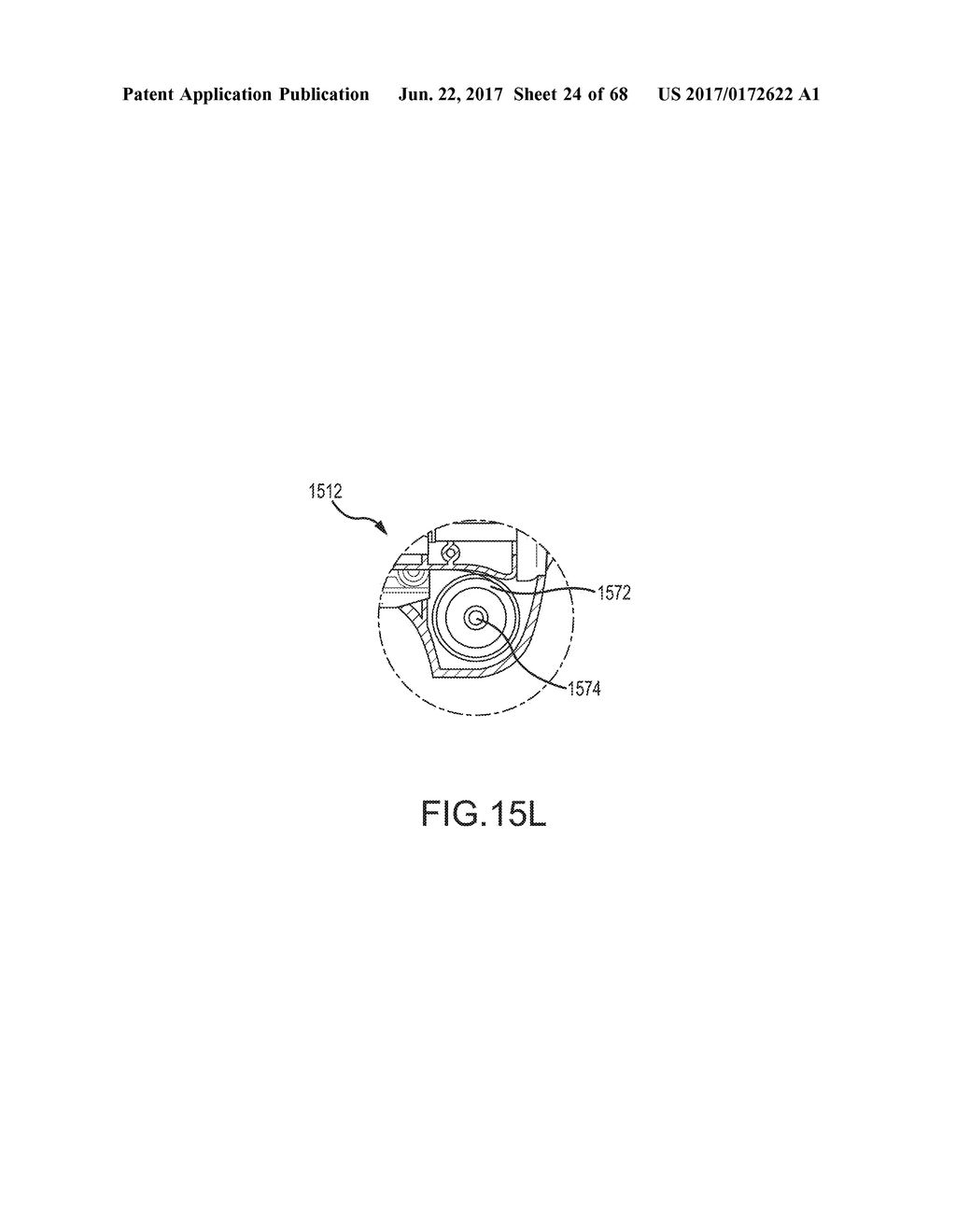 MEDICAL DEVICE FOR REMOVING AN IMPLANTED OBJECT - diagram, schematic, and image 25