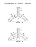 CANNULA WITH OPTICAL SENSING diagram and image