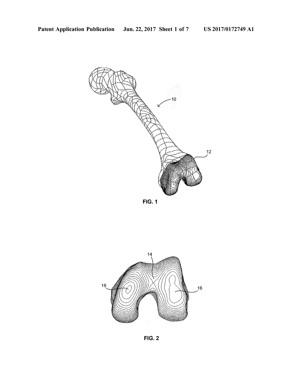 EXTENDED PATELLOFEMORAL - diagram, schematic, and image 02