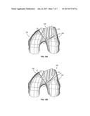 EXTENDED PATELLOFEMORAL diagram and image