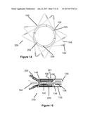 Stent And Stent Delivery Device diagram and image