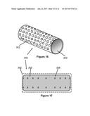 Stent And Stent Delivery Device diagram and image