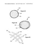 Stent And Stent Delivery Device diagram and image