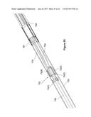 Stent And Stent Delivery Device diagram and image