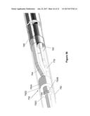 Stent And Stent Delivery Device diagram and image