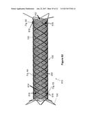 Stent And Stent Delivery Device diagram and image