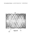 Stent And Stent Delivery Device diagram and image