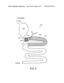 METHODS AND APPARATUS FOR ANCHORING WITHIN THE GASTROINTESTINAL TRACT diagram and image