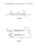 METHODS AND APPARATUS FOR ANCHORING WITHIN THE GASTROINTESTINAL TRACT diagram and image