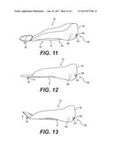 ORTHOTIC DEVICE FOR ASSISTING LIMB MOVEMENT diagram and image
