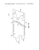 TWO-PART NON-PLANAR GRADUATED COMPRESSION DEVICE FOR THE TREATMENT OF     CIRCULATORY DISORDERS diagram and image