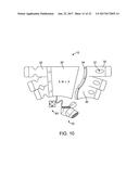 TWO-PART NON-PLANAR GRADUATED COMPRESSION DEVICE FOR THE TREATMENT OF     CIRCULATORY DISORDERS diagram and image