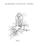 CPR ASSIST DEVICE FOR MEASURING COMPRESSION PARAMETERS DURING     CARDIOPULMONARY RESUSCITATION diagram and image