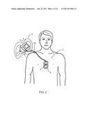 CPR ASSIST DEVICE FOR MEASURING COMPRESSION PARAMETERS DURING     CARDIOPULMONARY RESUSCITATION diagram and image