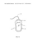 CPR ASSIST DEVICE FOR MEASURING COMPRESSION PARAMETERS DURING     CARDIOPULMONARY RESUSCITATION diagram and image