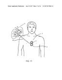 CPR ASSIST DEVICE FOR MEASURING COMPRESSION PARAMETERS DURING     CARDIOPULMONARY RESUSCITATION diagram and image