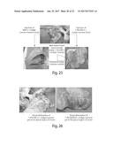 SELF-ASSEMBLING PEPTIDES AS BRONCHIAL OBSTRUCTION AGENTS diagram and image
