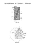 STEERABLE DELIVERY SHEATHS diagram and image