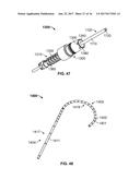 STEERABLE DELIVERY SHEATHS diagram and image