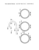 STEERABLE DELIVERY SHEATHS diagram and image