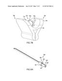 SPITTABLE NEEDLE diagram and image