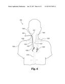 CATHETER SYSTEMS AND METHODS USEFUL FOR CELL THERAPY diagram and image