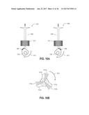 METHOD AND SYSTEM FOR VARIABLE CAM TIMING DEVICE diagram and image