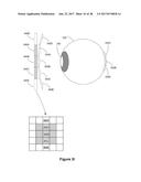 Enhanced Spatial Resolution using a Segmented Electrode Array diagram and image