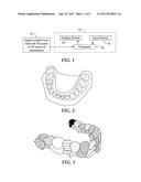 DETECTING TOOTH WEAR USING INTRA-ORAL 3D SCANS diagram and image