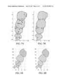 DETECTING TOOTH WEAR USING INTRA-ORAL 3D SCANS diagram and image