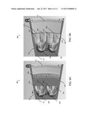 MITIGATING EFFECTS OF CAVITY RESONANCE IN SPEAKERS diagram and image